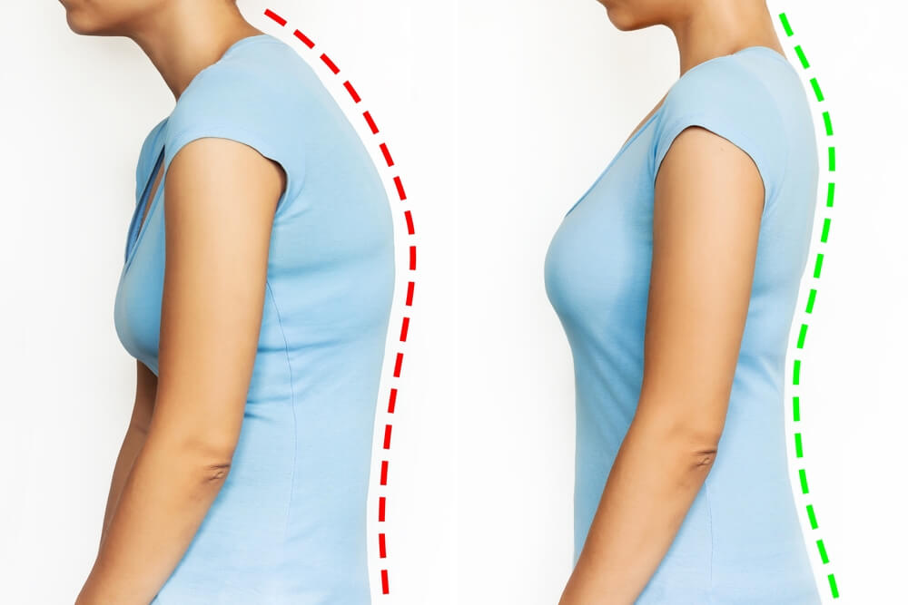Posture Correction